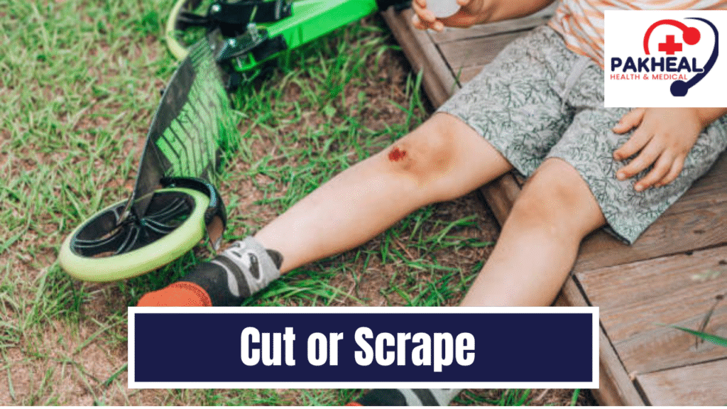 An image of If there's a cut or scrape