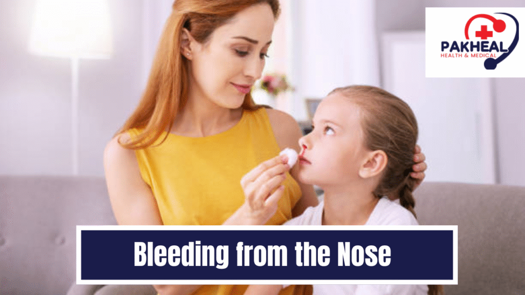 an image of bleeding from the nose