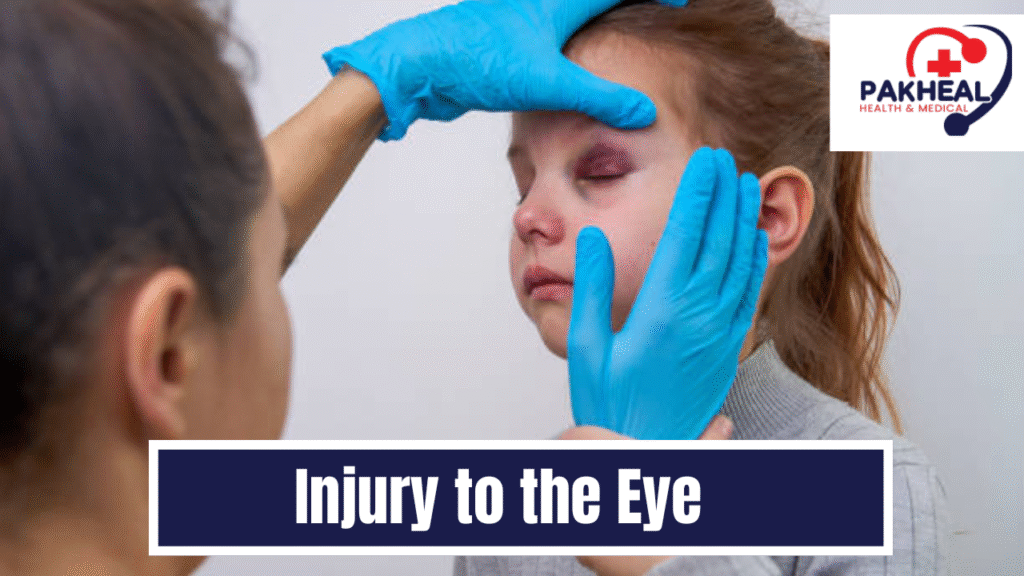 an image of Injury to the eye child