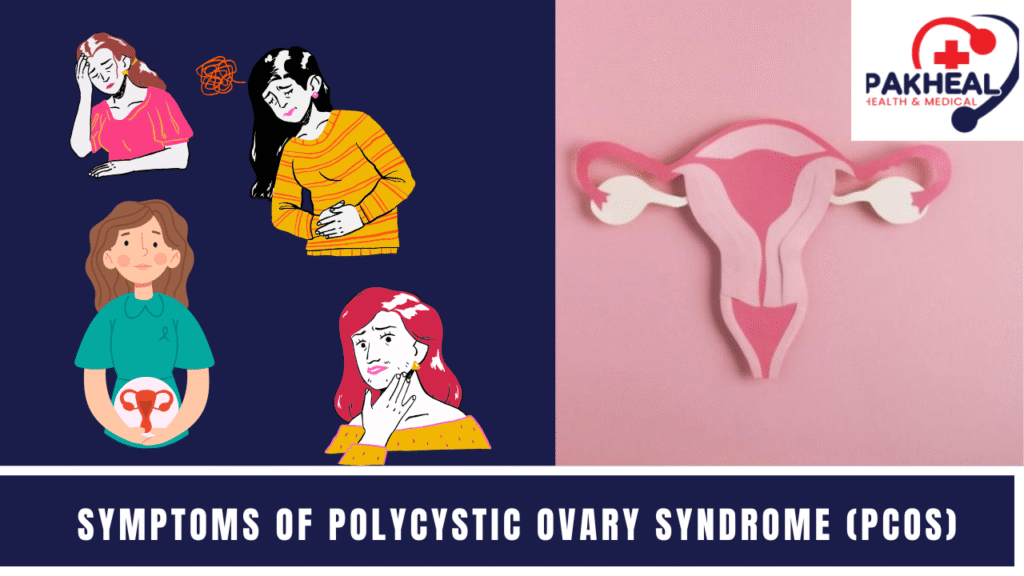 an image of "Symptoms of Polycystic Ovary Syndrome (PCOS)"