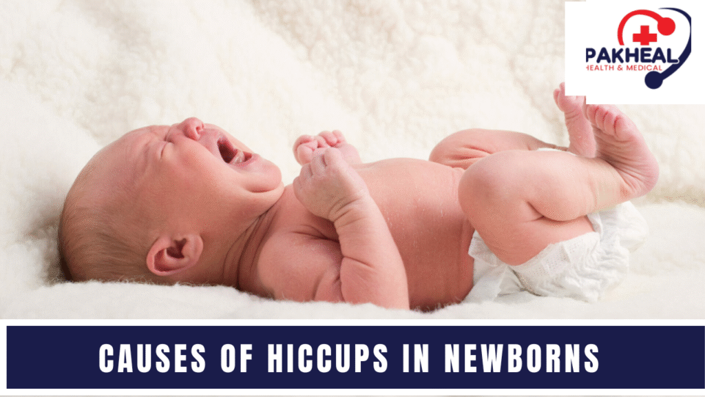 An image of causes of hiccups in newborns
