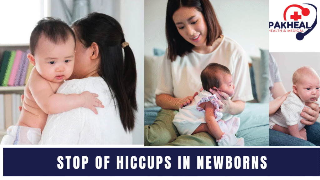 An image of stop Causes of hiccups in newborns