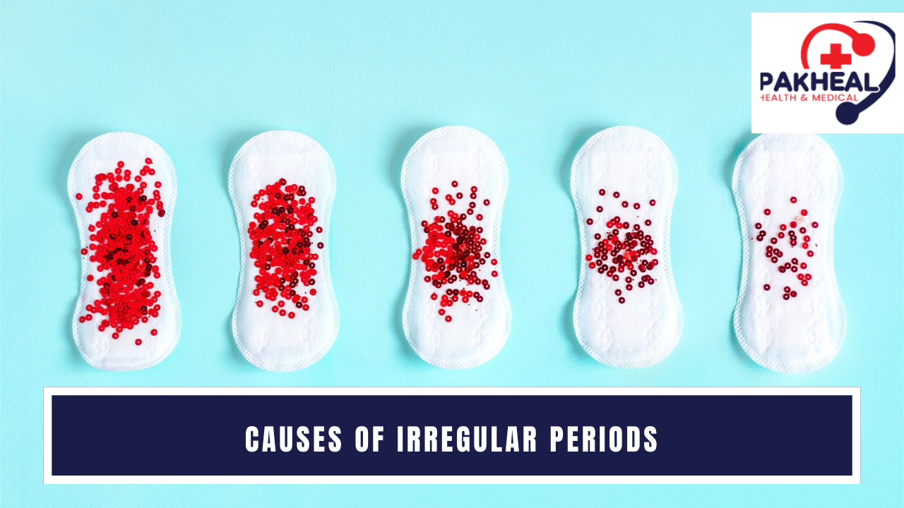 An image of causes of irregular periods