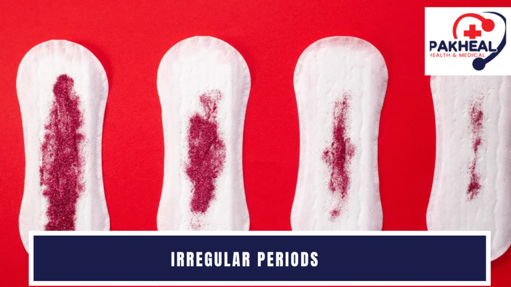 An image of causes of irregular periods