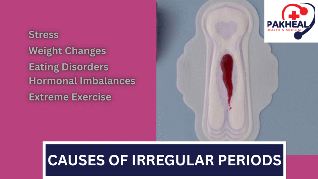 An image of Causes of Irregular Periods