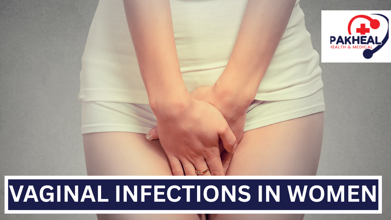 An image of vaginal infections in women