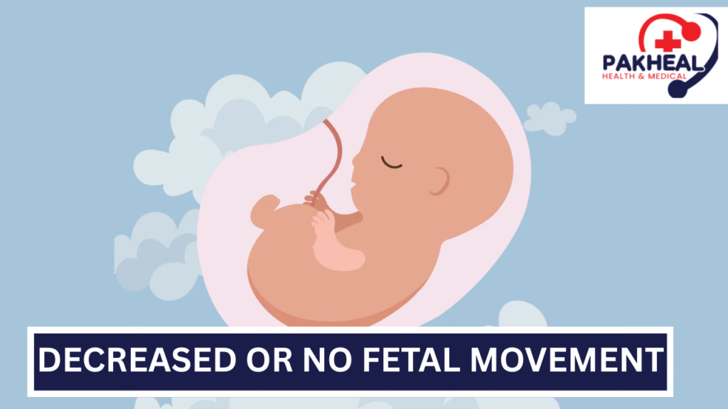 An image of decreased or no fetal movement