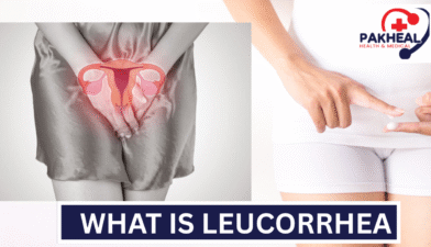 An image of what is leucorrhea