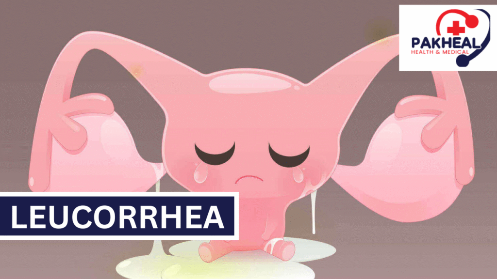 An image of leucorrhea