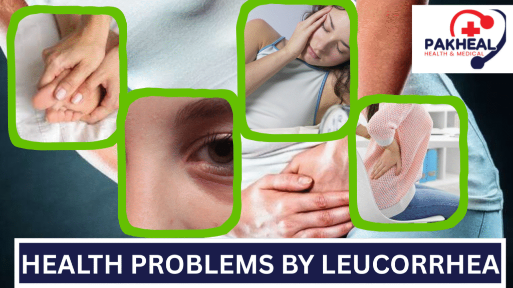 An image of health problems caused by leucorrhea