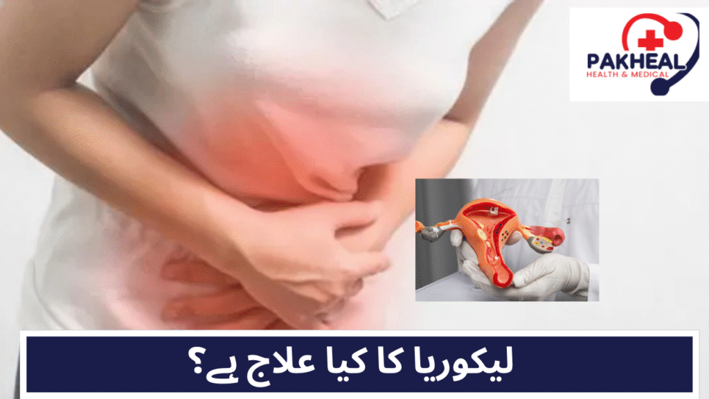 An image of causes of leucorrhea