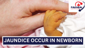 An image of jaundice occurring in newborn babies?