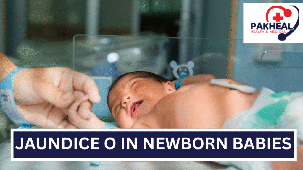 An image of jaundice occurring in newborn babies